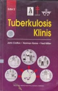 Tuberkulosis Klinis Edisi 2